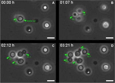 Ultrastructural Study of Cryptococcus neoformans Surface During Budding Events